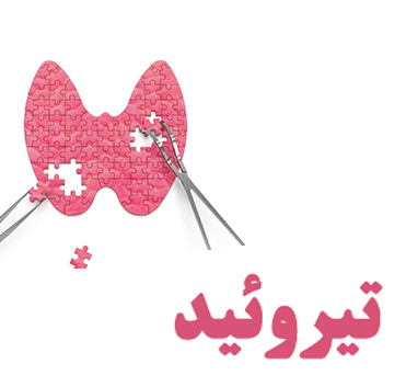 اثرات پرکاری تیروئید